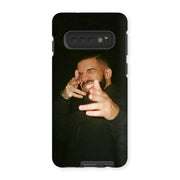 Choppa Case - Drake